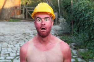 sunburned man wearing hard hat